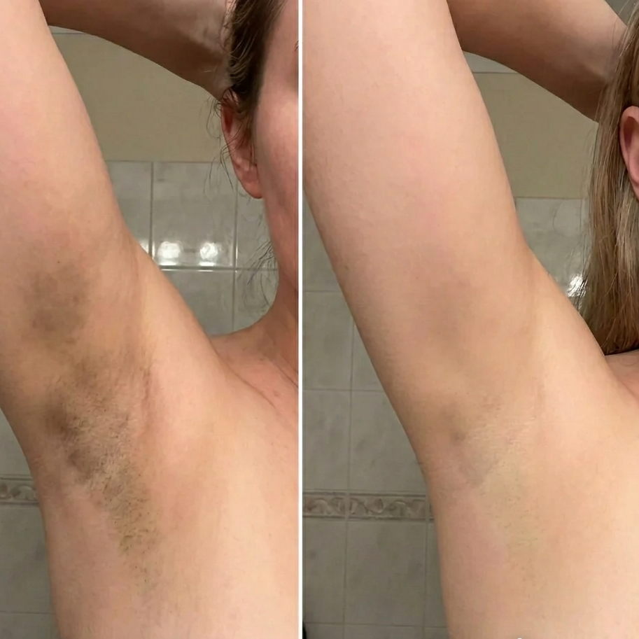 Clera - Spray exfoliant pour le corps
